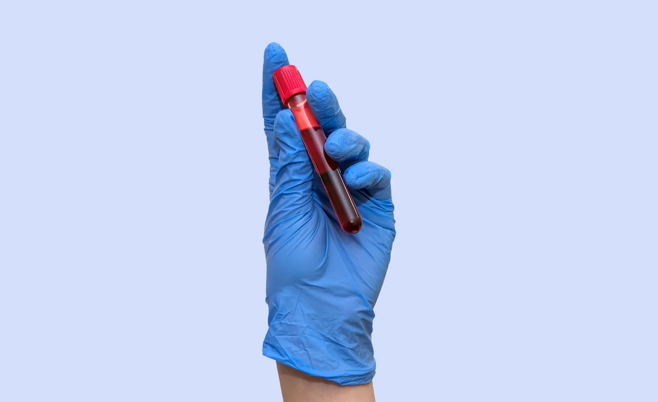 Blood Test